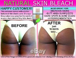 Natural Skin Care Kit for African American Black Women Skin Lightening Toning 7